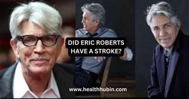 Photos: Did Eric Roberts Have A Stroke? Health Problems & Illness -Details To Know