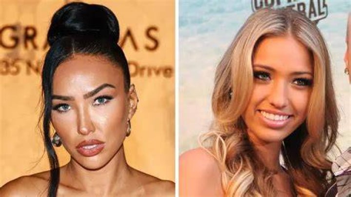 Selling Sunset's Bre Tiesi Shares Plastic Surgery Details |