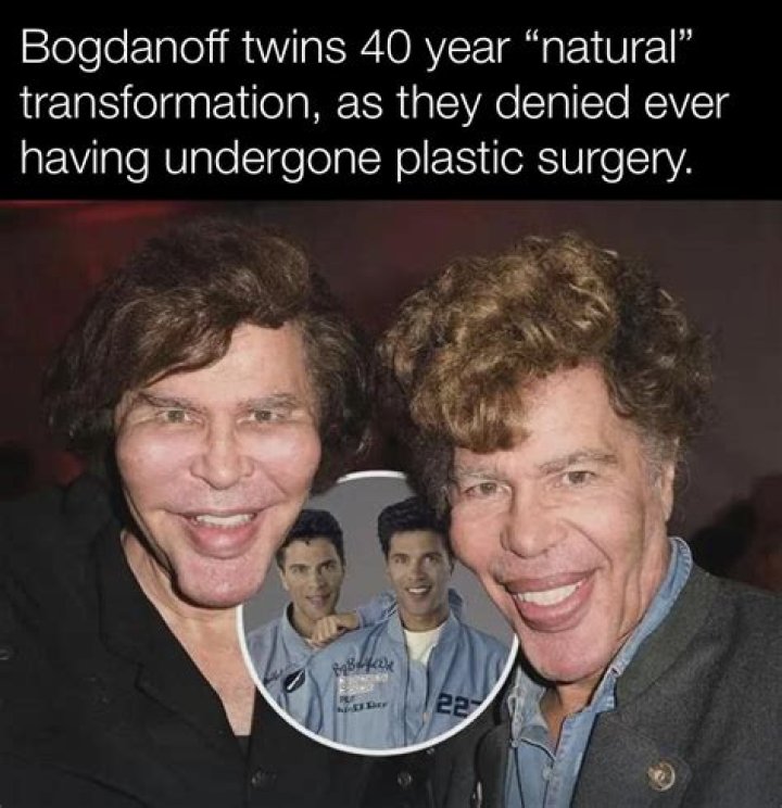 Unveiling Bogdanoff Plastic Surgery: Discoveries And Insights